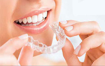 柏麗牙科 最新​牙齒美白特別促銷！