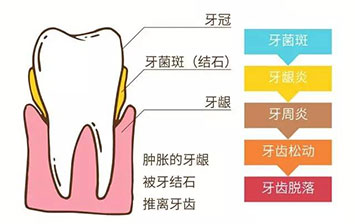 標準齒科醫院：你的口腔和用了十年的馬桶圈比到底哪個臟？