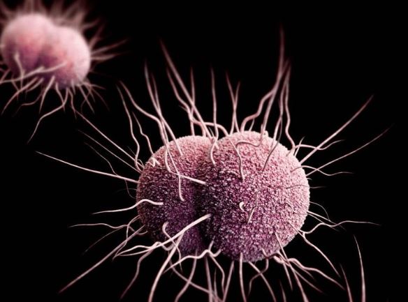 全美27州发现超级细菌 传播后果不堪设想