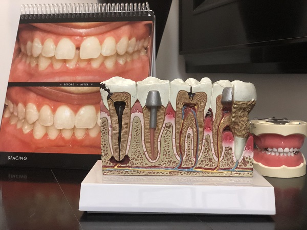 一口好牙，笑靨生花，專業醫師教你如何養護自己的牙齒 | 懷恩牙科診所─文振標醫師
