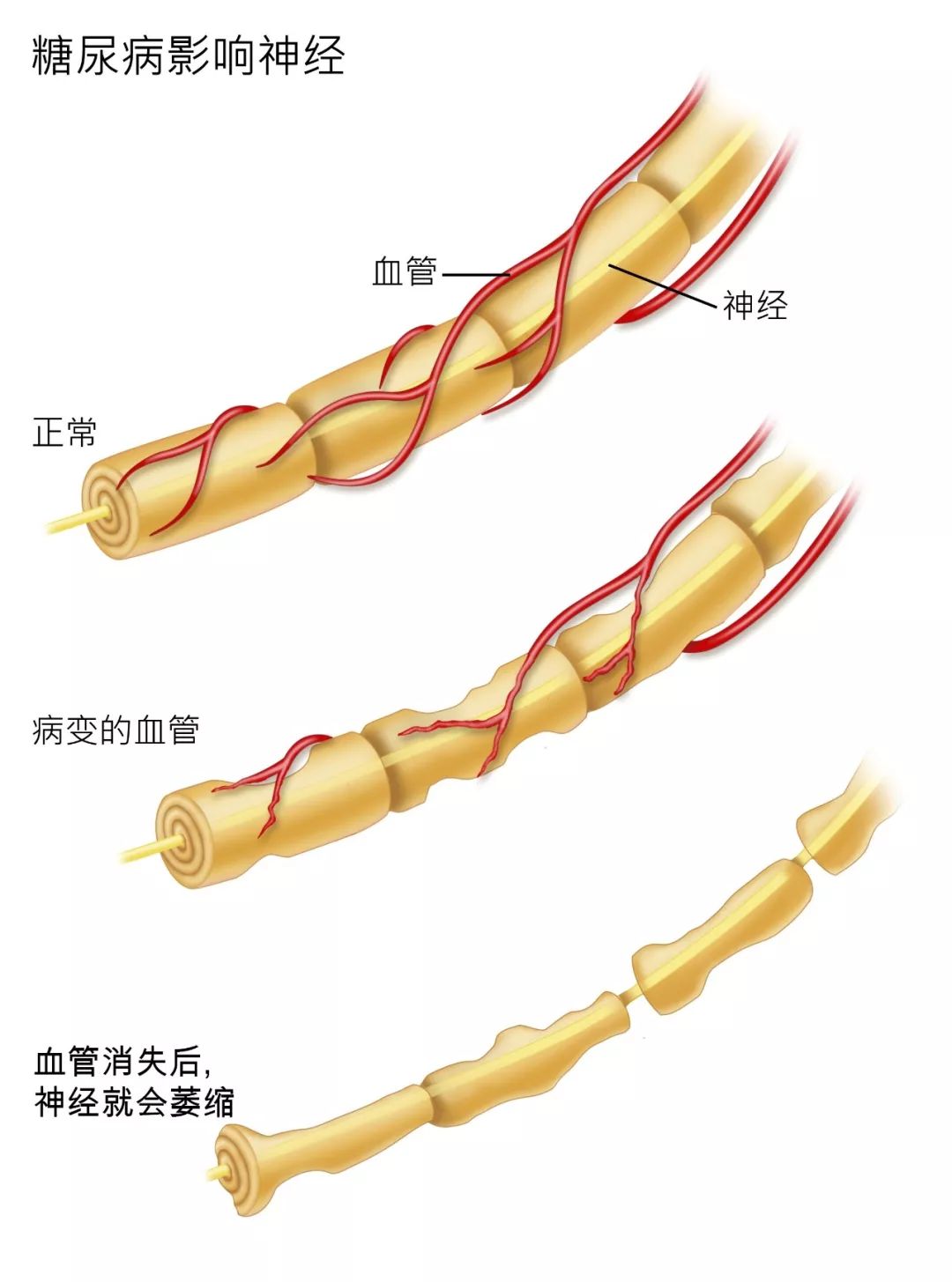 【健康】皮肤瘙痒千万别大意！或是糖尿病信号！