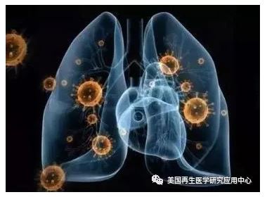 【医疗】脐带间充质干细胞治疗重症新冠肺炎取得初步疗效