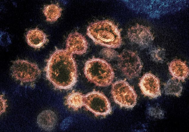 美国团队发现新冠病毒微型中和抗体,或成为有效防治方法!