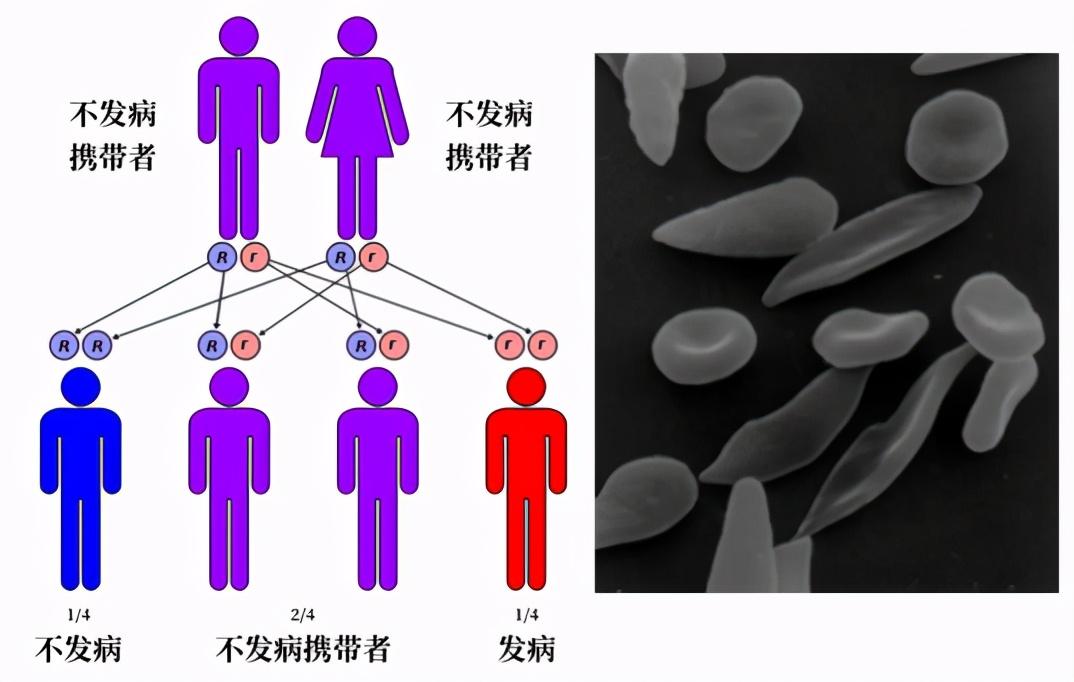 人类正在见证自己进化，科学家发现手臂长出新血管，颈部现新器官