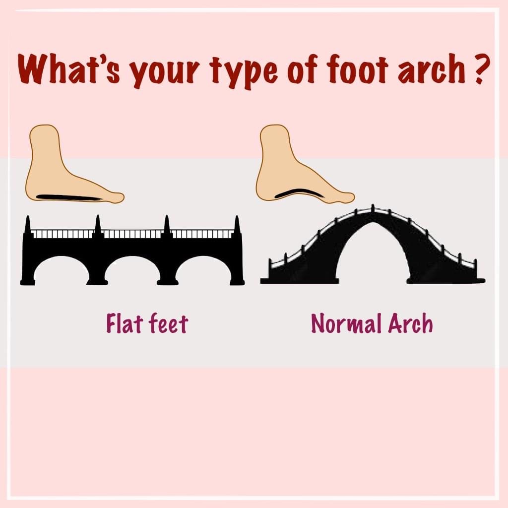【健康】你的足弓是哪一種？| 布朗朵莉足健康公司