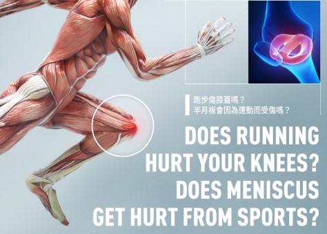 【醫學】跑步傷膝蓋嗎？半月板會因為運動而受傷嗎？ | 學善物理治療
