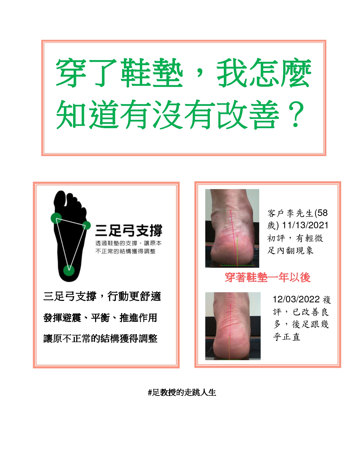 【健康】「足教授的走跳人生」穿了鞋墊，我怎麼知道有沒有改善？  | 布朗朵莉足健康公司