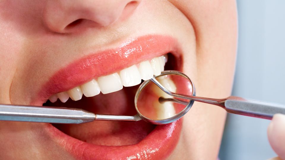 【牙科】深入了解人工植牙手術 | 爾灣植牙美容及家庭牙科