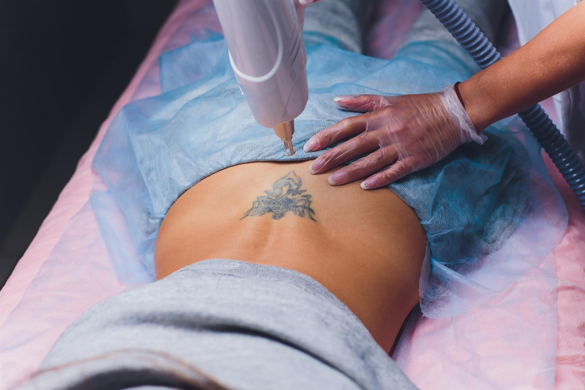 【刺青後悔潮】刺青後悔潮來襲！美國除刺青需求激增 知名歌手也坦言「很後悔」