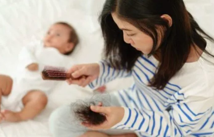 【医美】【产后掉发SOS】头发不是秃了，只是去度假了！5招召唤它们回来