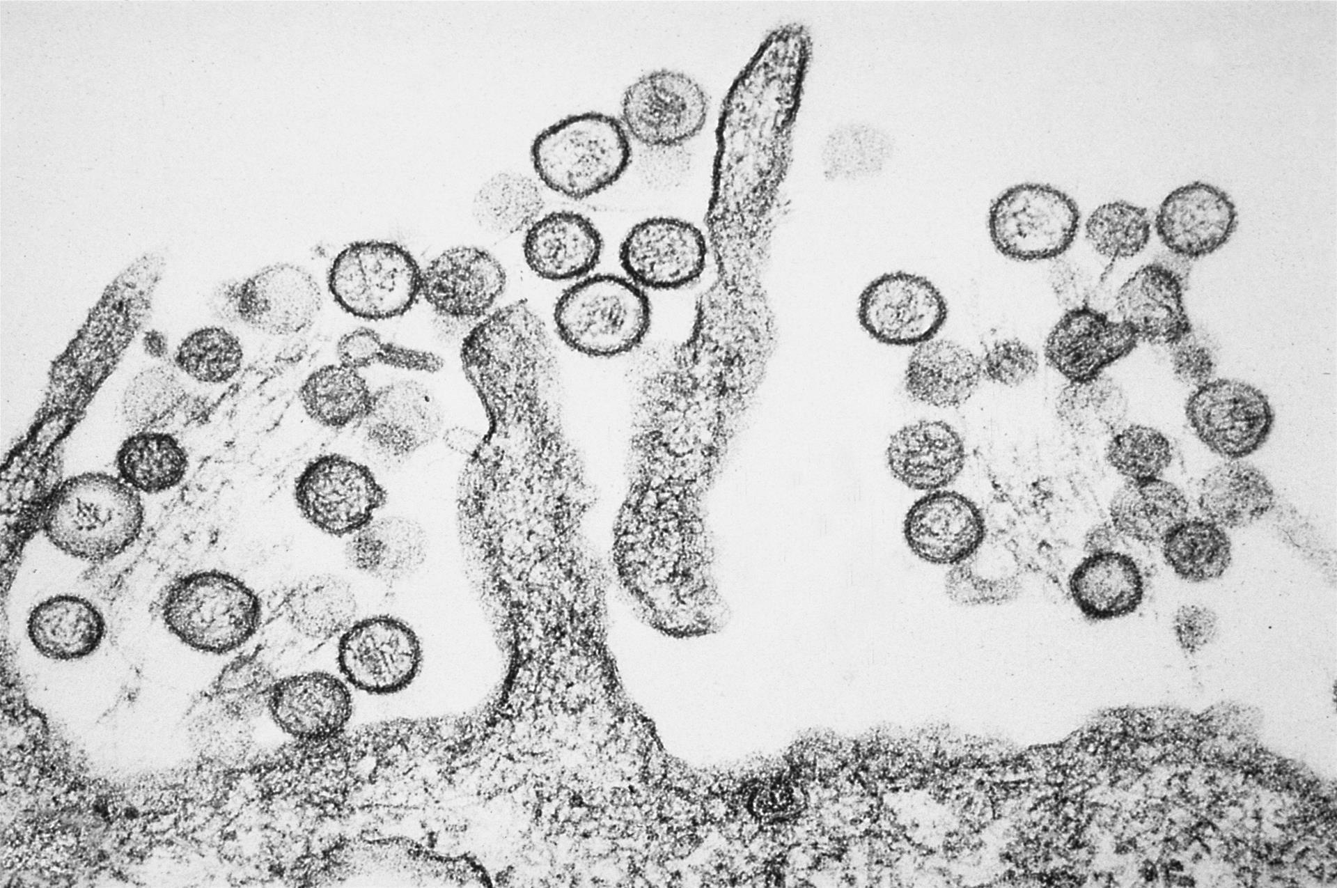 【維基百科】世衛：與美國、阿根廷合作應對郵輪漢他病毒疫情