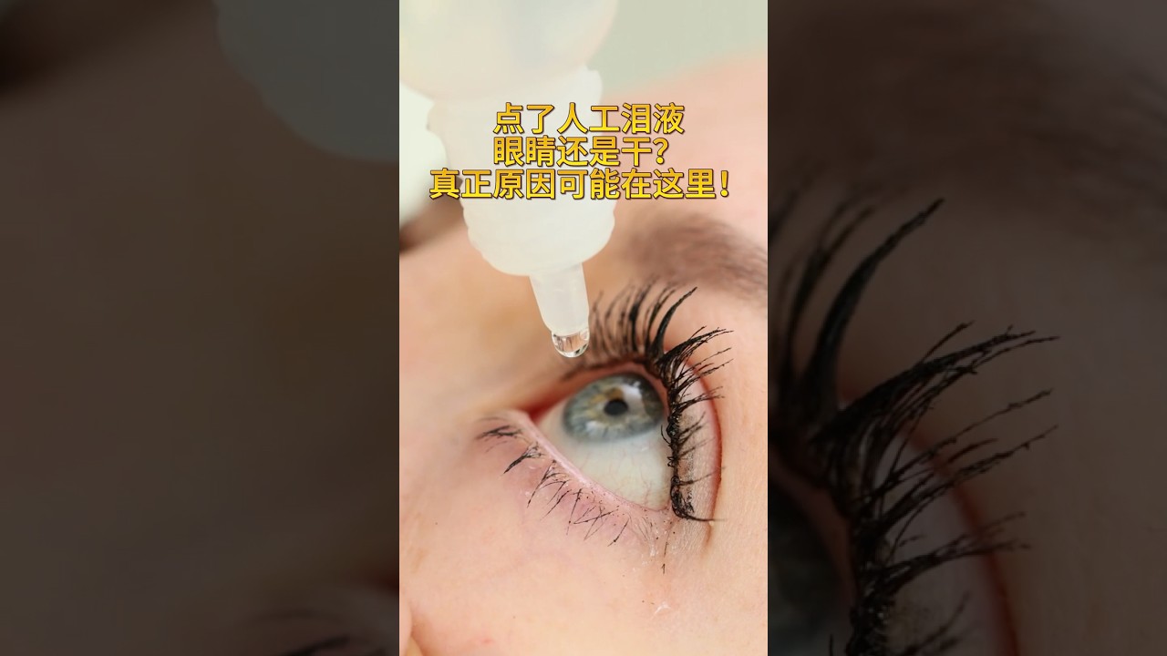 点了人工泪液眼睛还是乾❓真正原因可能在这里❗️