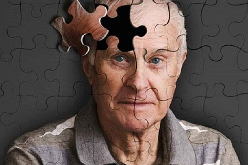 刺激性脑力活动可预防老年认知功能障碍