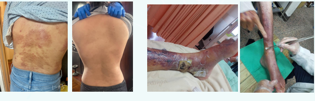 「以子之矛攻子之盾」 诊冶方法