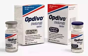 美国希望之光医疗：免疫治疗药Nivolumab能改善头颈部复发性鳞状细胞癌患者的生存