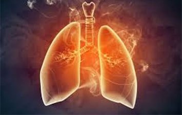 美国希望之光医疗：腺癌并脑膜转移可能性大如何治疗