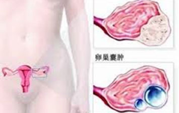 美国希望之光医疗：《临床肿瘤进展：ASCO 2017年度报告》系列9